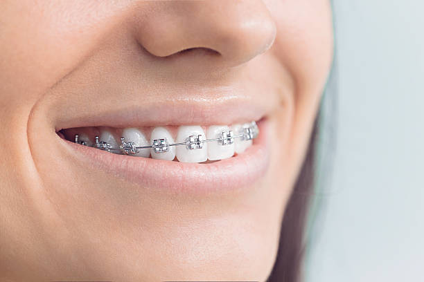 Why Choose Us for Your Dental Needs in Del City, OK
